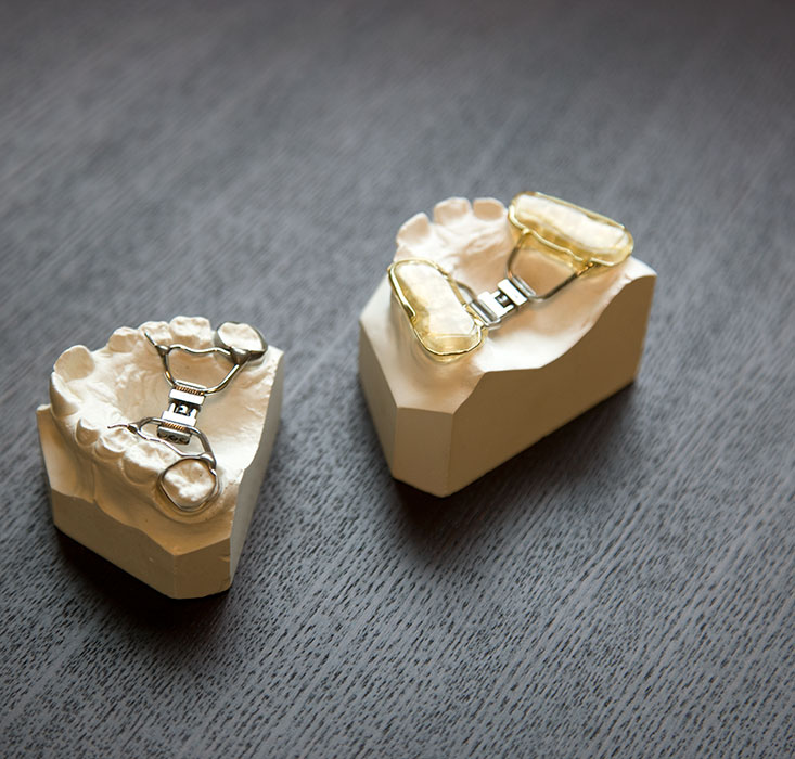 Orthodontic molds